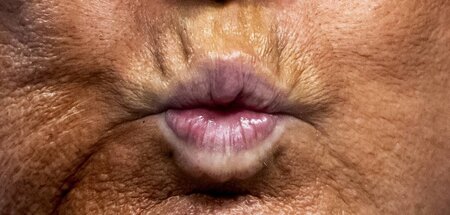 Donalds Duckface Donalds Duckface